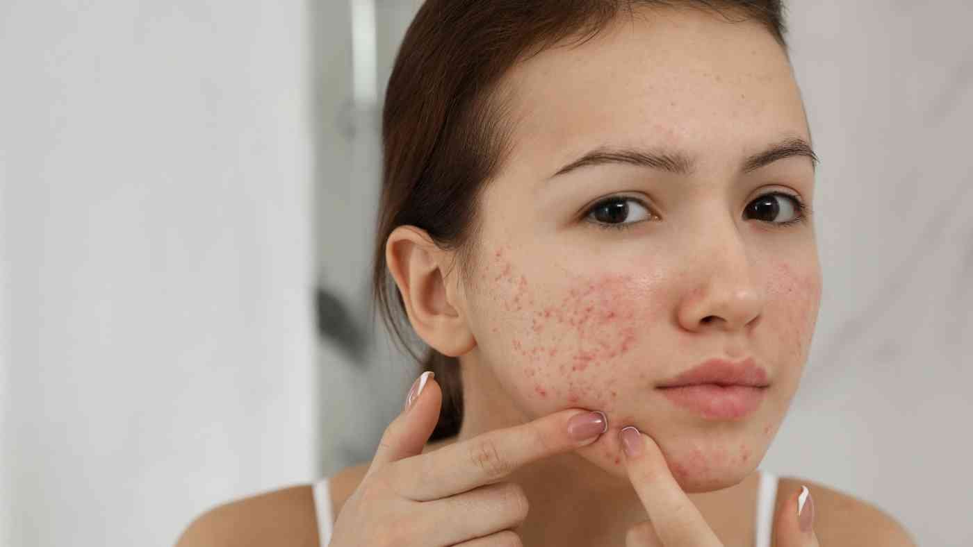 Navigating Skin Health in 2024: Common Issues and Solutions in India