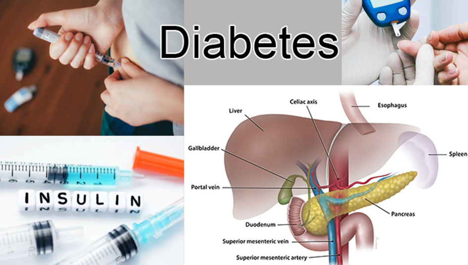 Facts & Complications about Diabetes – ଡାଇବେଟିସର ଉପଚାର ନକଲେ କଣ ଅସୁବିଧା ହେବ