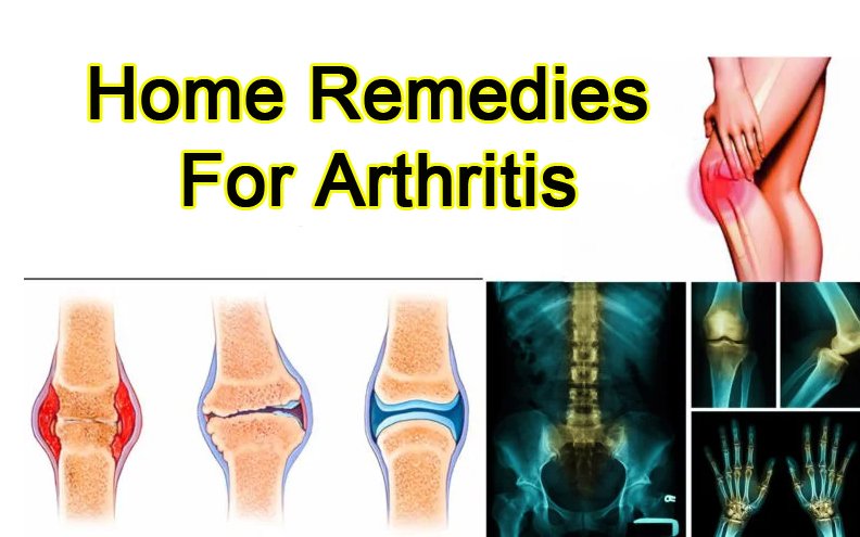 Home Remedies For Arthritis