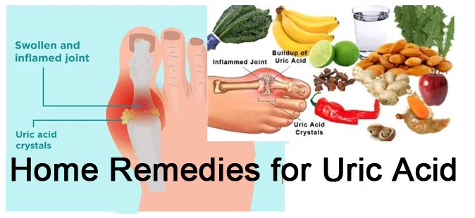 How to Reduce Uric Acid – Easy Home Remedies to Reduce Uric Acid