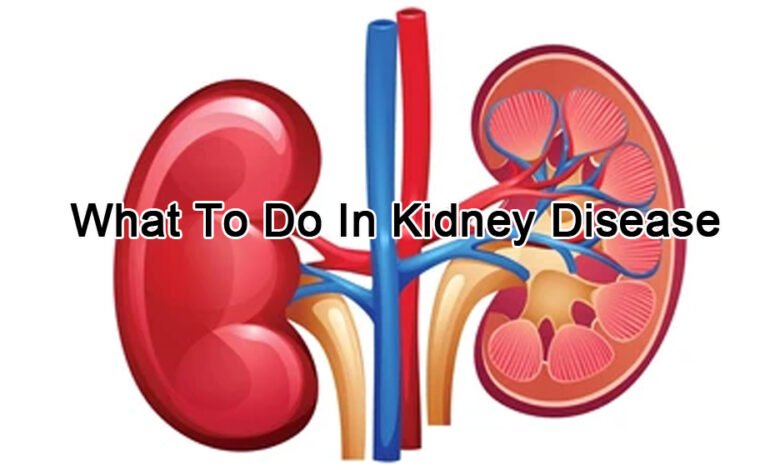 Causes of Kidney Disease – What to Do/Don’t Do