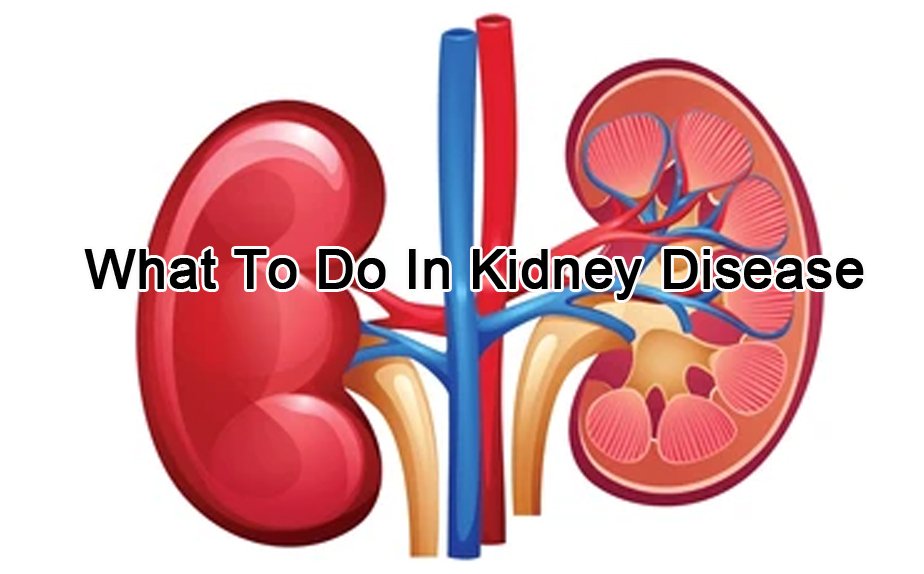 Causes of Kidney Disease – What to Do/Don’t Do