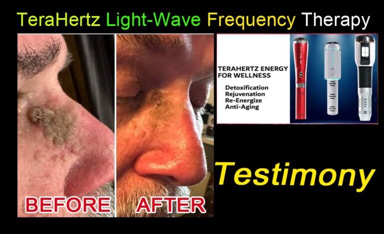 Terahertz Therapy Testimony Photos